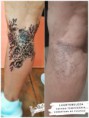 /album/galeria-de-fotos-tatuagem-gel-cicatriz/whatsapp-image-2020-01-24-at-15-00-59-jpg1/